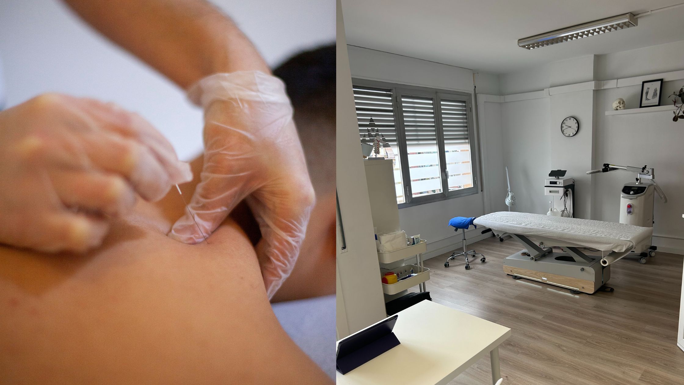 fisioterapia en barcelona